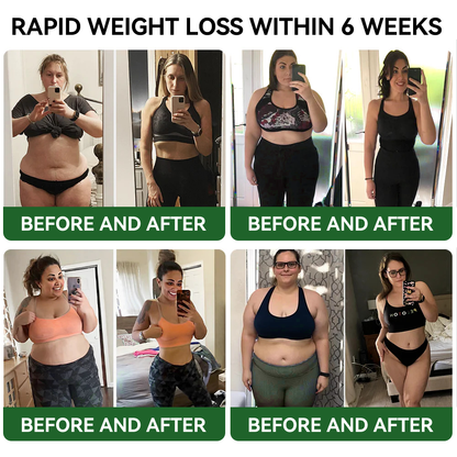 TLOPA® GLP-1 Slimming & Health Boost Drops | Potravinársky spaľovač tukov (Vyvinutý Spoločnosťou pre obezitu)